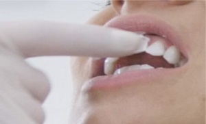 After-Whitening-Mousse auftragen