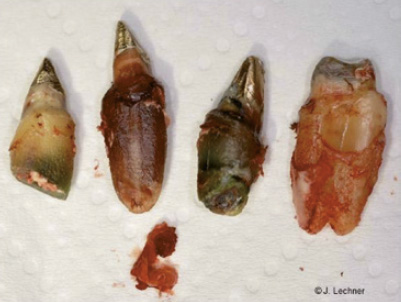 tote zähne durch wurzelbehandlung